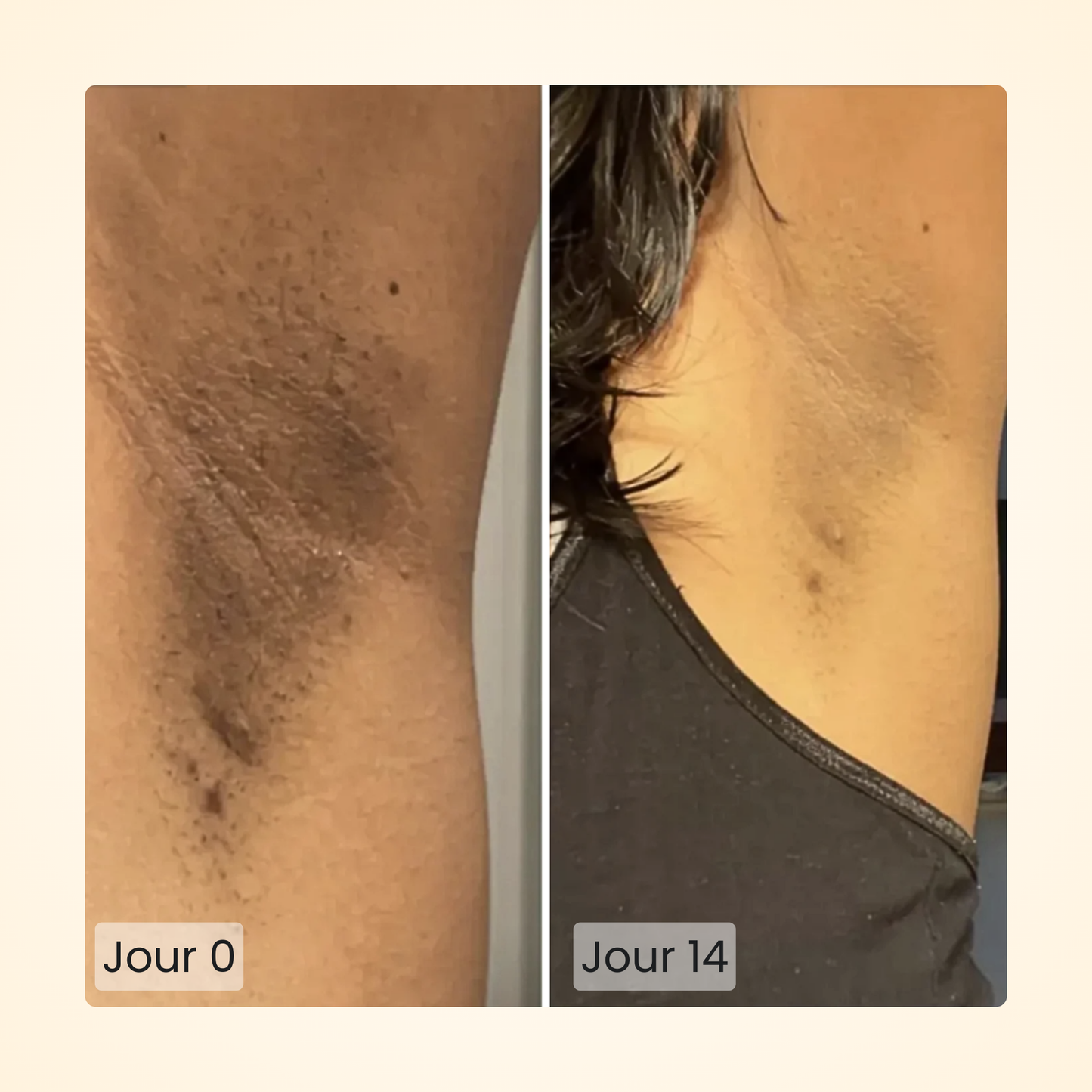 Gloomi® Skin Essence Bar (Duo) + Kit Routine