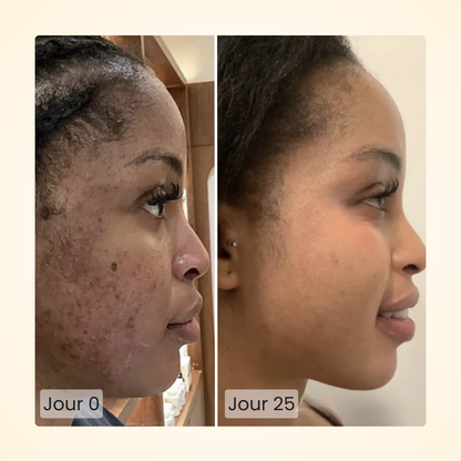 Gloomi® Skin Essence Bar (Duo) + Kit Routine