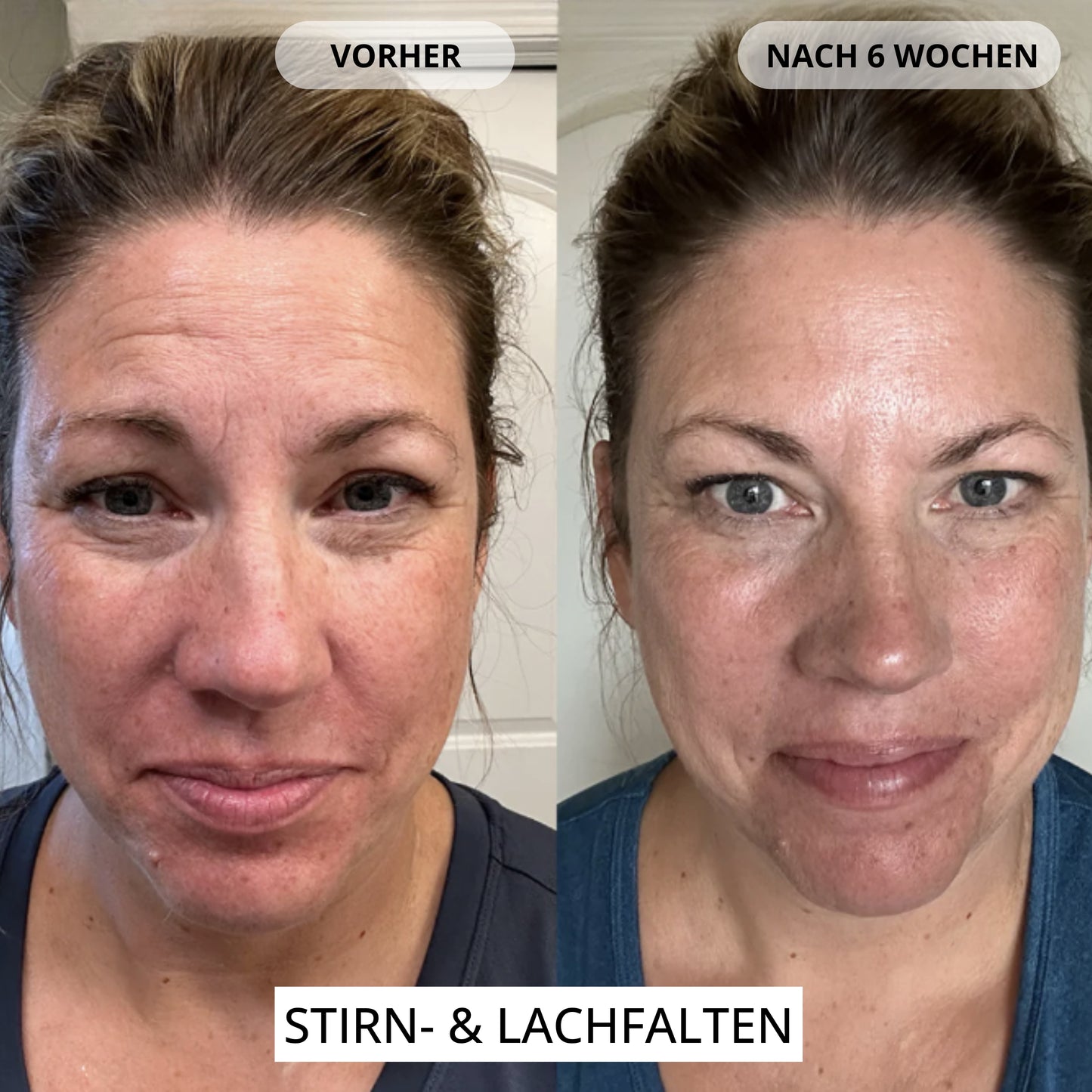 Renewal & Plumping Konzentrat