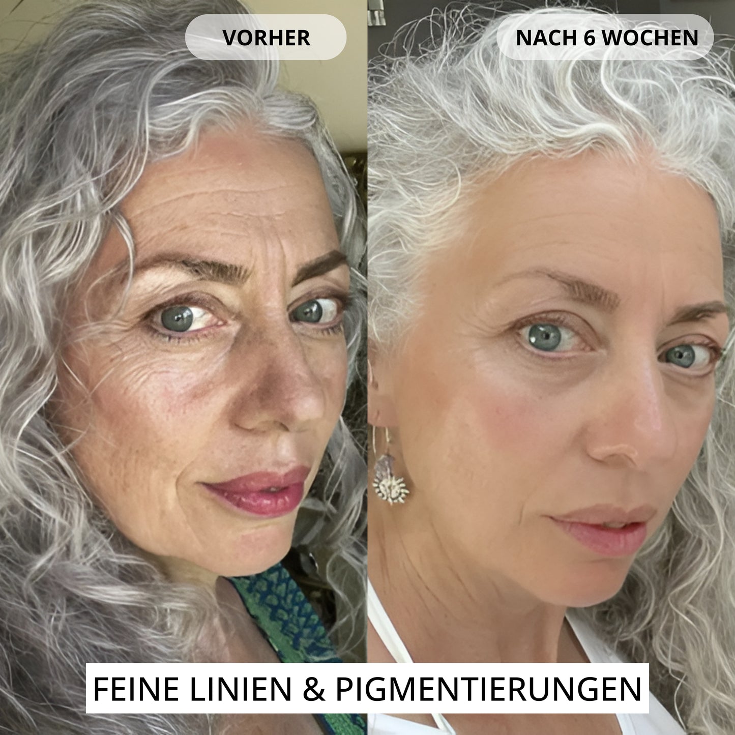 Renewal & Plumping Konzentrat