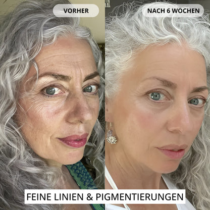 Renewal & Plumping Konzentrat