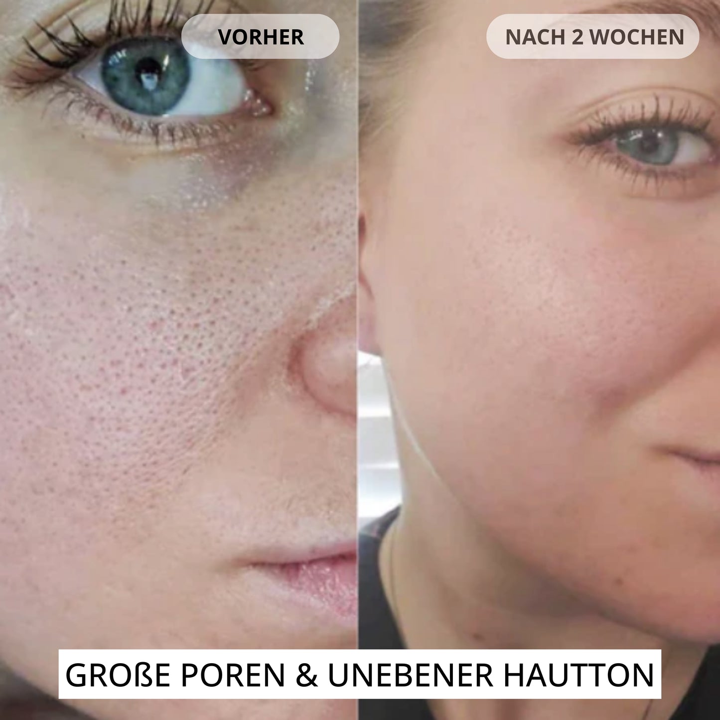 Renewal & Plumping Konzentrat