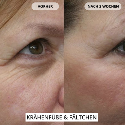 Renewal & Plumping Konzentrat