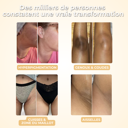 Gloomi® Skin Essence Bar (Duo) + Kit Routine