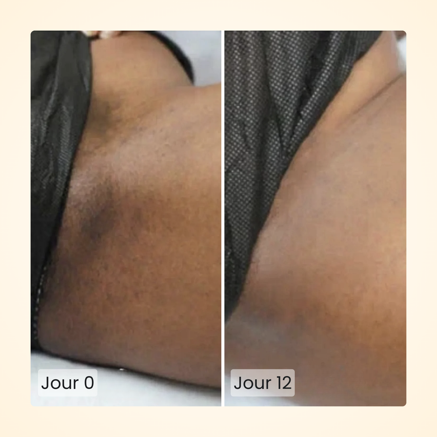 Gloomi® Skin Essence Bar (Duo) + Kit Routine