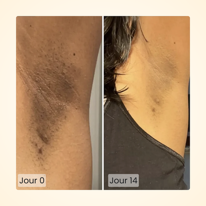 Gloomi® Skin Essence Bar (Duo) + Kit Routine