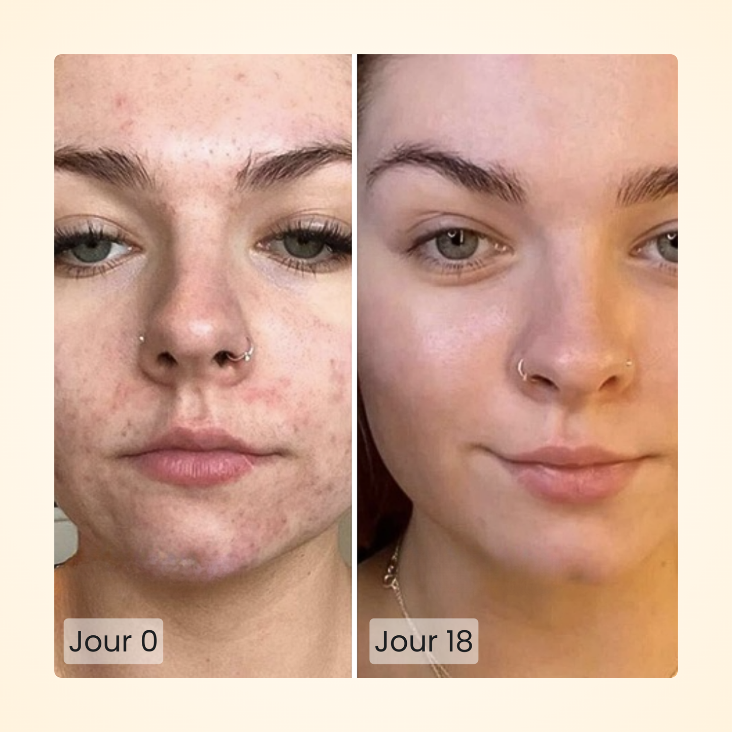 Gloomi® Skin Essence Bar (Duo) + Kit Routine